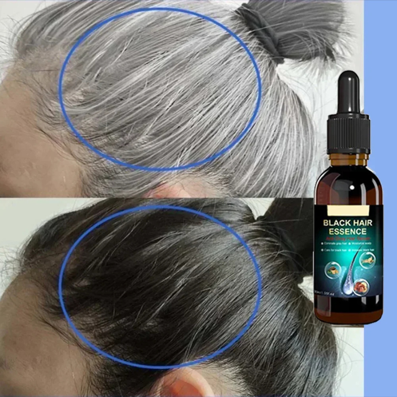 Black Essence Hair Renewal Serum